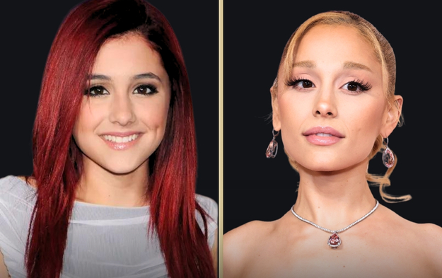 Ariana Grande Plastic Surgery: Then and Now